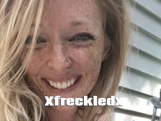 Xfreckledx